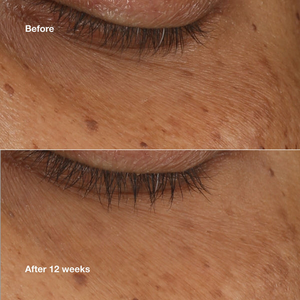 V5H8C7C1054D2ADF0B16E5C343758BDC6B4R6436466P2