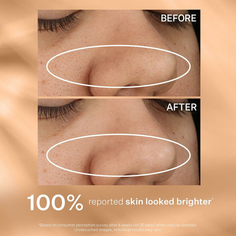 V4H72432FC4EC50195EE2436F7FD6A0062ER7352206P6